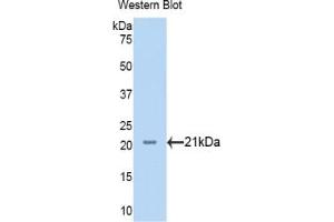 Detection of Recombinant NRP1, Human using Polyclonal Antibody to Neuropilin 1 (NRP1) (Neuropilin 1 antibody  (AA 646-814))