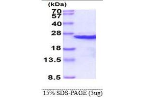 SDS-PAGE (SDS) image for Calcium and Integrin-Binding Protein 1 (CIB1) (AA 1-191) protein (His tag) (ABIN666637)