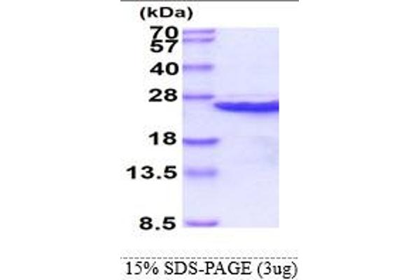 CIB1 Protein (AA 1-191) (His tag)