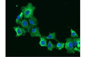 ICC/IF analysis of EPHX1 in Hep3B cells line, stained with DAPI (Blue) for nucleus staining and monoclonal anti-human EPHX1 antibody (1:100) with goat anti-mouse IgG-Alexa fluor 488 conjugate (Green). (EPHX1 antibody  (AA 21-455))
