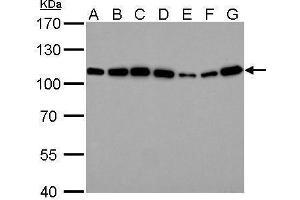 Western Blotting (WB) image for anti-Actinin, alpha 4 (ACTN4) (C-Term) antibody (ABIN2855119)