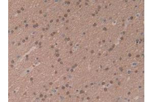IHC-P analysis of Human Brain Tissue, with DAB staining. (MTOR antibody  (AA 2226-2488))