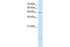 Western Blotting (WB) image for anti-Pleckstrin and Sec7 Domain Containing 3 (PSD3) antibody (ABIN2462580) (PSD3 antibody)