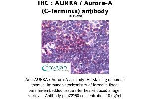 Image no. 1 for anti-Aurora Kinase A (AURKA) (C-Term) antibody (ABIN1732111) (Aurora A antibody  (C-Term))