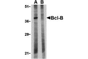 Western Blotting (WB) image for anti-BCL2-Like 10 (Apoptosis Facilitator) (BCL2L10) (N-Term) antibody (ABIN1031267) (BCL2L10 antibody  (N-Term))