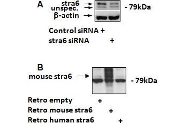 STRA6 antibody  (C-Term)
