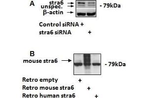 ABIN5539909 (1. (STRA6 antibody  (C-Term))