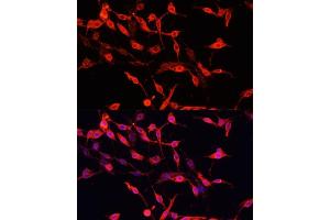 Immunofluorescence analysis of PC-12 cells using ENO3 antibody (ABIN7266960) at dilution of 1:100. (ENO3 antibody  (AA 1-190))
