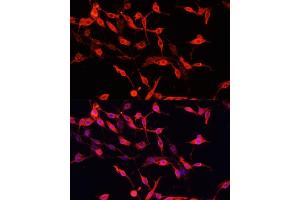 Immunofluorescence analysis of PC-12 cells using ENO3 antibody (ABIN7266960) at dilution of 1:100.