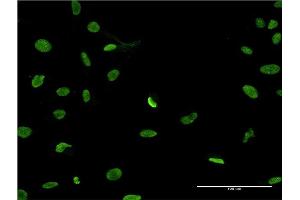 Immunofluorescence of monoclonal antibody to PTMS on HeLa cell.