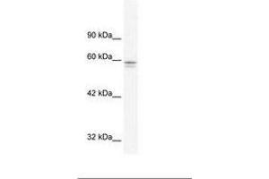 Image no. 1 for anti-Metal-Regulatory Transcription Factor 1 (MTF1) (AA 562-611) antibody (ABIN202901) (MTF1 antibody  (AA 562-611))
