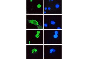 Immunofluorescence staining of Cos-1 cells transfected with (top to bottom) full length hLEF-1, a LEF-1 mutant missing the nuclear localization signal, TCF-4 and TCF-1. (LEF1 antibody)