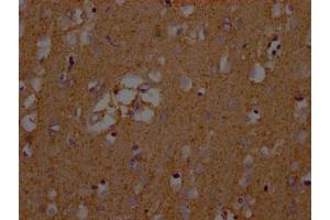 IHC image of ABIN7152226 diluted at 1:200 and staining in paraffin-embedded human brain tissue performed on a Leica BondTM system. (SLC1A3 antibody  (AA 146-236))