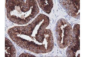 Immunohistochemistry (IHC) image for anti-T-cell surface glycoprotein CD1c (CD1C) antibody (ABIN1497187) (CD1c antibody)