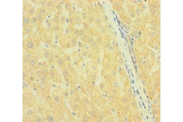 SLC38A9 antibody  (AA 1-119)