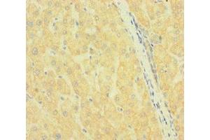 Immunohistochemistry of paraffin-embedded human liver tissue using ABIN7169972 at dilution of 1:100 (SLC38A9 antibody  (AA 1-119))