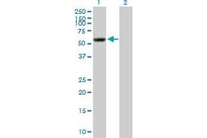 Western Blot analysis of PI4KII expression in transfected 293T cell line by PI4KII MaxPab polyclonal antibody.