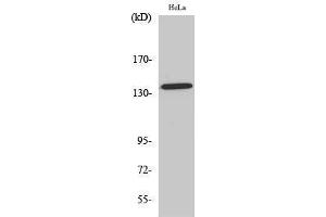 Western Blotting (WB) image for anti-Amyloid beta (Abeta) (pThr743) antibody (ABIN3182732) (beta Amyloid antibody  (pThr743))