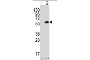 Western blot analysis of CSIN1 (arrow) using rabbit polyclonal CSIN1 Antibody (G23) (ABIN392664 and ABIN2842162). (PACSIN1 antibody  (N-Term))