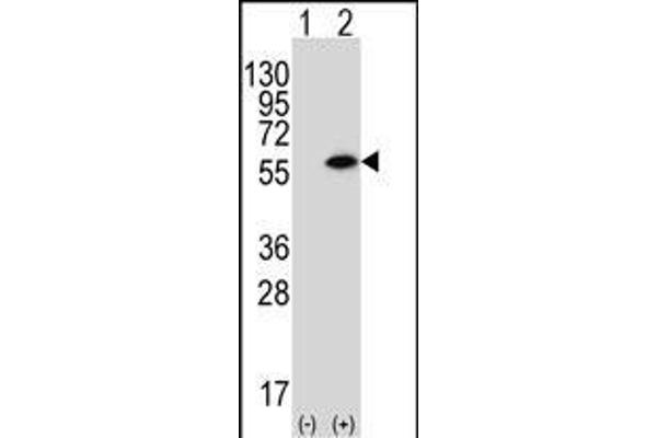 PACSIN1 antibody  (N-Term)