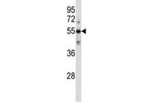 C9 antibody western blot analysis in ZR-75-1 lysate