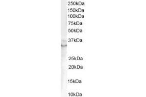 Image no. 1 for anti-Growth Differentiation Factor 15 (GDF15) (C-Term) antibody (ABIN374600) (GDF15 antibody  (C-Term))