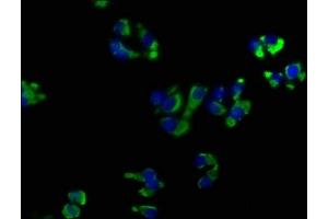 Immunofluorescence staining of HepG2 cells with ABIN7139899 at 1:50, counter-stained with DAPI. (OPRK1 antibody  (AA 31-50))
