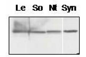 Western blot analysis of chloroplast proteins from tomato (Lycopersicum esculentum, Le, spinach (Spinacia oleracea, So), tobacco (Nicotiana tabacum, Nt) and membrane proteins from Synechocystis sp. (PsbQ antibody)