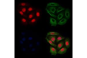 ABIN6255287 and ABIN6267691 staining Hela cells(4h of LPS treatment) by IF/ICC. (RACGAP1 antibody  (pSer387))
