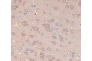 Figure. (Cathepsin D antibody  (AA 54-121))