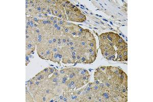 Immunohistochemistry of paraffin-embedded human stomach using THBS2 antibody (ABIN5996361) at dilution of 1/100 (40x lens).