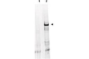 Anti-ATM Monoclonal Antibody - Western Blot Anti ATM Mab with human derived HEK293 cells treated with doxorubicin using  Protein A Purified Mab anti-ATM Protein Kinase pS1981(clone 10H11. (ATM antibody  (pSer1981))