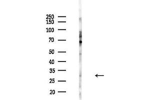 anti-E74-Like Factor 5 (Ets Domain Transcription Factor) (ELF5) (Internal Region) antibody