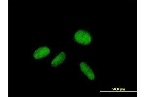 Immunofluorescence of purified MaxPab antibody to ZNF584 on HepG2 cell. (ZNF584 antibody  (AA 1-421))
