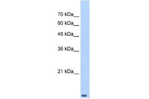 WB Suggested Anti-TCEB2 Antibody Titration: 0. (TCEB2 antibody  (Middle Region))