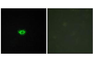 Immunofluorescence analysis of HUVEC cells, using GP108 antibody. (GPR108 antibody  (Internal Region))