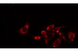 ABIN6275148 staining  Hela cells by IF/ICC. (GJC1 antibody  (C-Term))