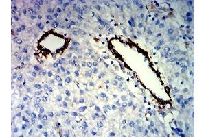 Immunohistochemistry (IHC) image for anti-Friend Leukemia Virus Integration 1 (FLI1) (AA 303-452) antibody (ABIN7193672)