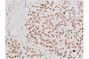 Immunohistochemistry (IHC) image for anti-Nuclear Factor-kB p65 (NFkBP65) (pThr435) antibody (ABIN6255688)