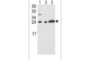 Western blot analysis of ARHGDIA Antibody in A375(lane 1),HL-60(lane 2),Ramos(lane 3) cell line lysates (35ug/lane) (ARHGDIA antibody  (C-Term))