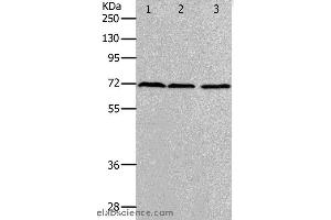 Western blot analysis of K562, hela and 293T cell, using PRMT5 Polyclonal Antibody at dilution of 1:400 (PRMT5 antibody)