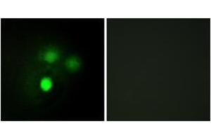 Immunofluorescence analysis of HuvEc cells, using KNTC2 Antibody. (NDC80 antibody  (AA 351-400))