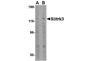 Image no. 1 for anti-SLIT and NTRK-Like Family, Member 3 (SLITRK3) (C-Term) antibody (ABIN1493361) (SLITRK3 antibody  (C-Term))