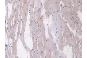IHC-P analysis of Rat Heart Tissue, with DAB staining. (Angiopoietin 1 antibody  (AA 304-450))