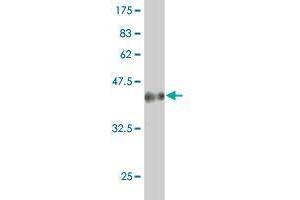 Western Blot detection against Immunogen (37. (EXOC1 antibody  (AA 780-879))