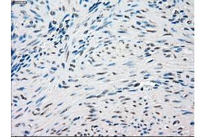 Immunohistochemical staining of paraffin-embedded Ovary tissue using anti-SSBmouse monoclonal antibody. (SSB antibody)