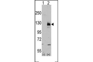 Image no. 2 for anti-Transient Receptor Potential Cation Channel, Subfamily M, Member 8 (TRPM8) (C-Term) antibody (ABIN360717) (TRPM8 antibody  (C-Term))