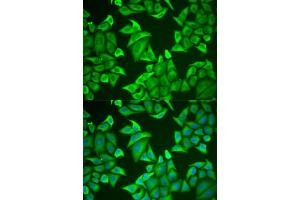 Immunofluorescence analysis of U2OS cells using NGB antibody (ABIN5973872). (Neuroglobin antibody)