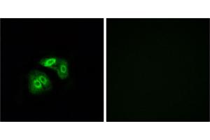 Immunofluorescence analysis of A549 cells, using VN1R5 antibody.