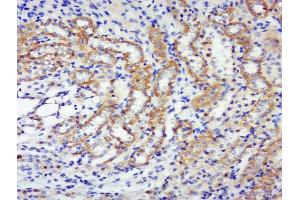 Paraformaldehyde-fixed, paraffin embedded rat kidney, Antigen retrieval by boiling in sodium citrate buffer (pH6) for 15min, Block endogenous peroxidase by 3% hydrogen peroxide for 30 minutes, Blocking buffer (normal goat serum) at 37°C for 20min, Antibody incubation with p70 S6 Kinase Beta (Thr444 + Ser447) Antibody, Unconjugated  at 1:400 overnight at 4°C, followed by a conjugated secondary and DAB staining. (RPS6KB2 antibody  (pSer447, pThr444))
